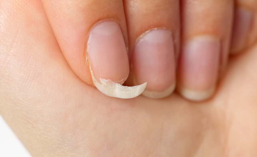 la manucure peut-être impactant pour la solidité des ongles, il convient alors de suivre ces conseils pour éviter d'avoir des ongles fragiles et cassants